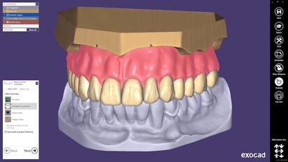 exocad DentalCAD 2.4 Plovdiv现已发布 数字化全口义齿从未如此简单