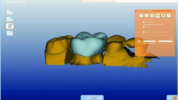 CAD/CAM Technology: a review