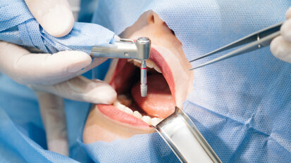 Henry Schein to enter Brazil’s dental implants market with acquisition of S.I.N.