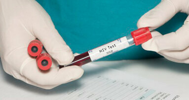 Derivati dei batteri parodontali potrebbero riattivare l’HIV latente