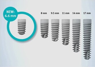 DENTSPLY Implants introduceert nieuw kort ANKYLOS-implantaat
