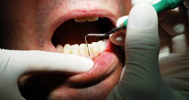 歯周病治療が医療費や入院を減らす可能性