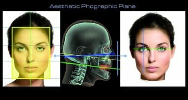 Aesthetic Digital Smile Design: Software-aided aesthetic dentistry—Part I