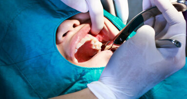Avoiding common problems in tooth extractions