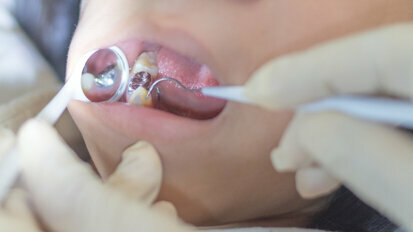 Particulate mercury is significant source of exposure to mercury in dental profession