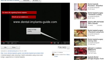 Ocenjen je kvalitet video-sadržaja namenjenih stomatolozima na Jutjubu