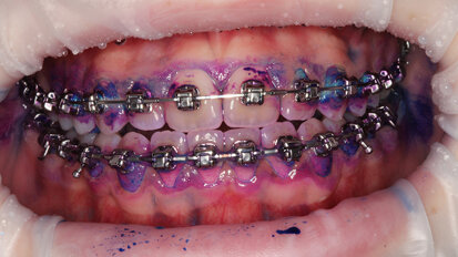 The orthodontic patient - From hell to heaven