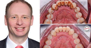 Oral biofilm: A concern for all dental professionals