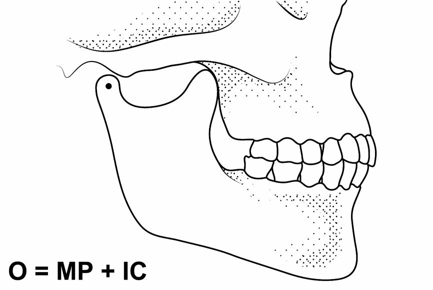 Fig. 1: Mandibular position with condyles seated in the fossae and no intercuspation.