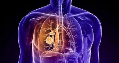 Atemtest soll Krebserkrankung erkennen