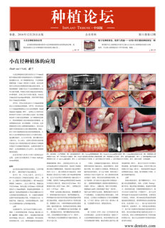 Implant Tribune China No. 5, 2016