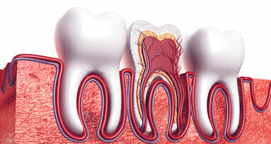 Study analyses unique root canal anatomy patterns in Indian population