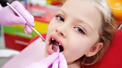 دراسة تحدد أنواع بكتيريا جديدة  مساهمة في تكوين تسوس الأسنان