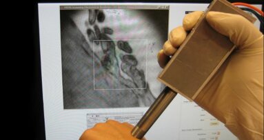 Novel portable probe detects early oral cancer