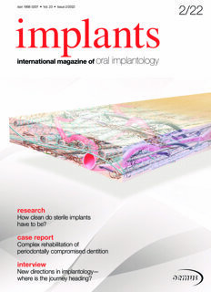 implants international No. 2, 2022
