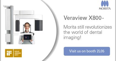 Veraview X800: More safety and precision in 3-D