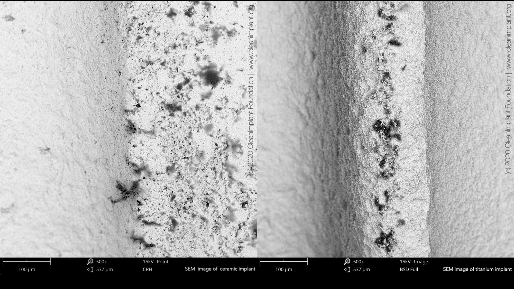 Sterile and yet dirty?