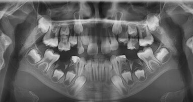 Przyszłość radiologii stomatologicznej