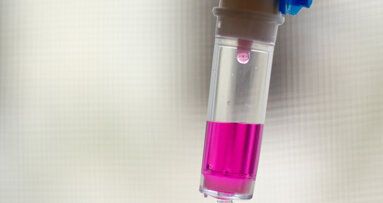 Chemotherapie: Laser kann Entwicklung oraler Mukositis hemmen