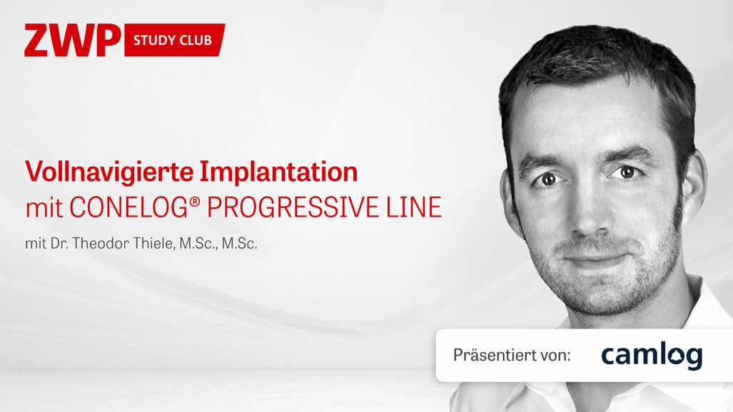 Vollnavigierte Implantation mit CONELOG PROGRESSIVE-LINE