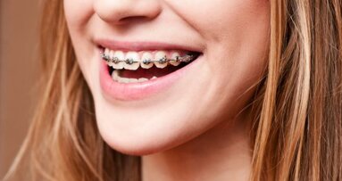 NZa past tarieven orthodontie aan