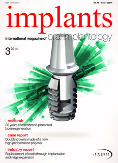implants international No. 3, 2014
