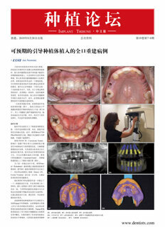 Implant Tribune China No. 4, 2019