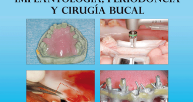 Imprescindible Guía de Implantología, Periodoncia y Cirugía Bucal