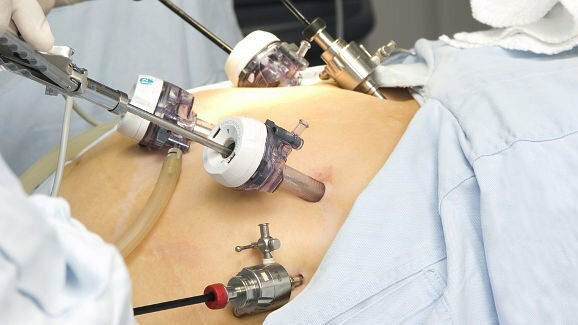 Cirurgia bariátrica pode ter impacto negativo na saúde bucal