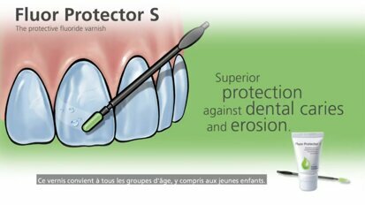 Application du vernis Fluor Protector S