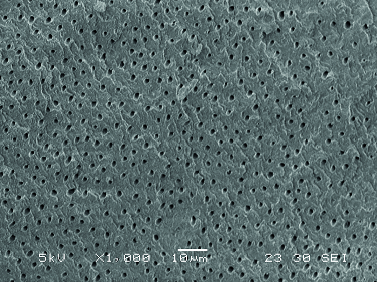 Fig. 1a: Scanning electron microscope (SEM) images of unprotected open dentine tubuli before treatment with nHAp agent by PrevDent.