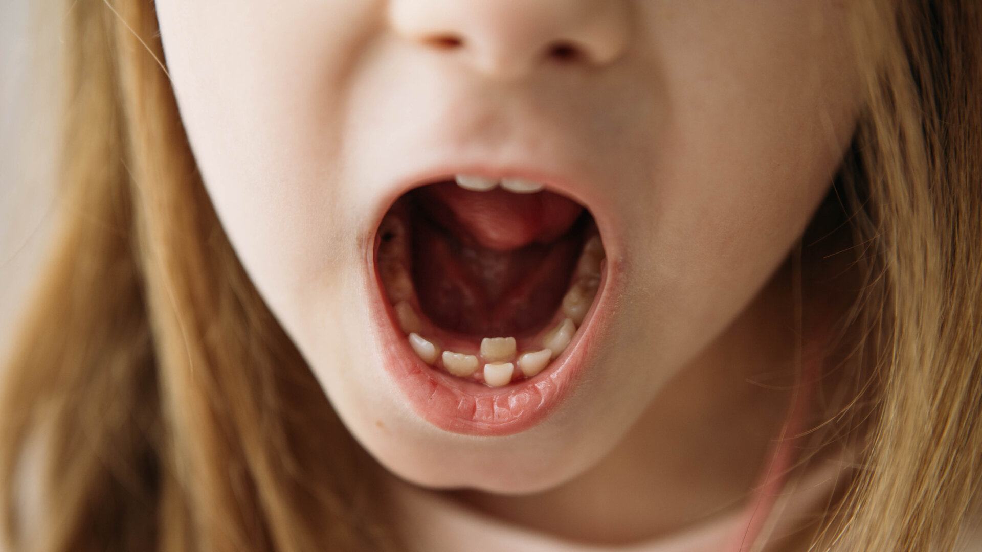 New study examines effects of different anti-cancer therapy on oral health