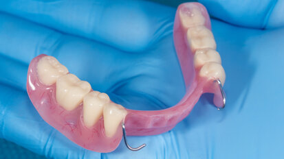 Dr Graham Stokes teaches dentists how to “provide stable, functional and aesthetically pleasing partial dentures”