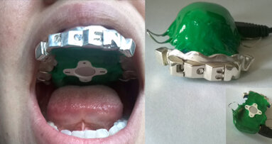 Il primo lettore MP3 dentale sviluppato da uno studente di design