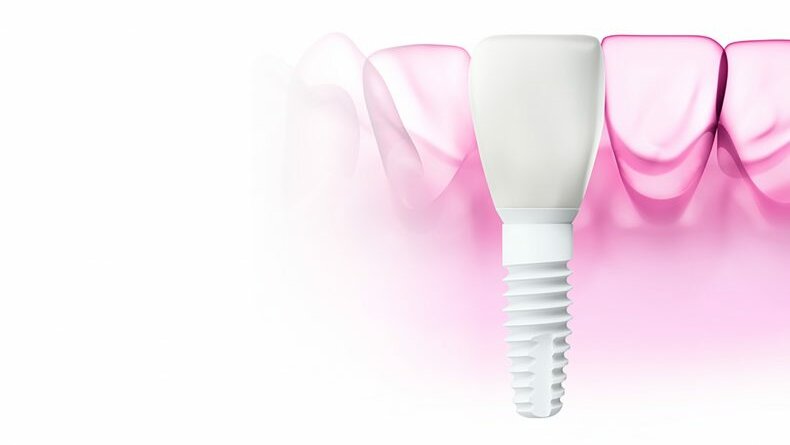Biotech Dental ajoute l’implant céramique ZERAMEX XT à son catalogue