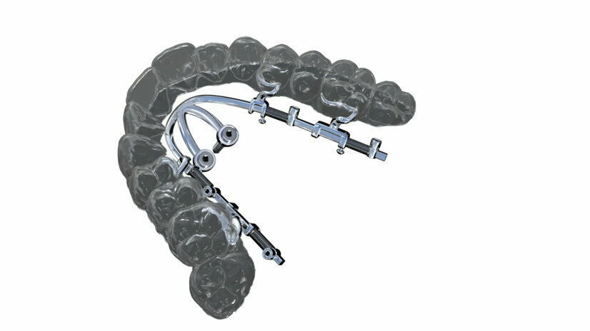Dental Aligners Magazine