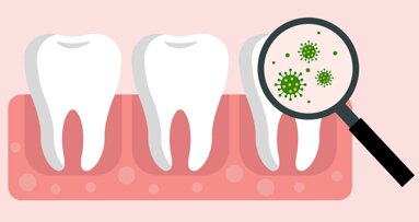 Eisenmangelanämie: Therapie findet Anwendung in Zahnmedizin