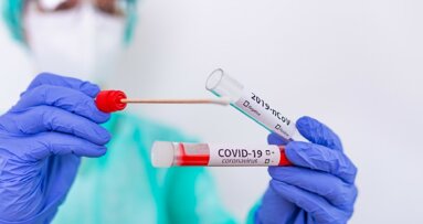 COVID-19: indagini e test epidemiologici. Proposta AIO al Ministro della Salute Roberto Speranza