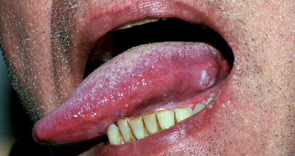 Researchers investigate how tongue reacts to different textures in food