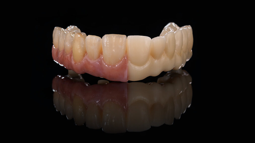 Zolid Bion: Amann Girrbach brings new zirconia to market