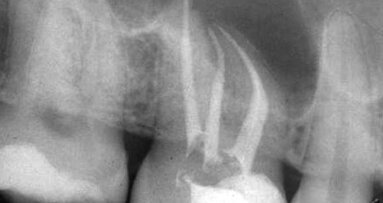 Critical thinking: the missing link in endodontic education