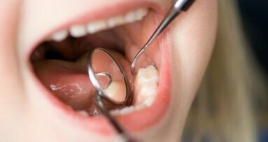 Nederlander vaker naar tandarts