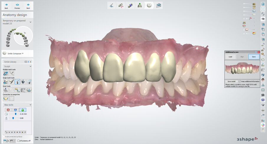 3Shape’s lab software users are future proofing their business by joining the digital revolution in dentistry. 3Shape dental labs can now more easily communicate and exchange data with their customers using Dentsply Sirona’s Primescan.