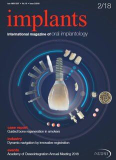 implants international No. 2, 2018