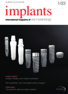implants international No. 1, 2023