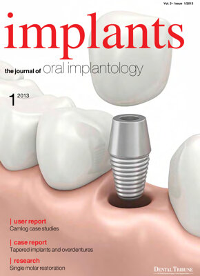 implants UK No. 1, 2013