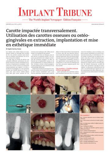 Implant Tribune France No. 1, 2022