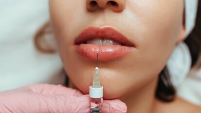 Hyaluronzuurfillers: kunnen vollere lippen te vol zijn?