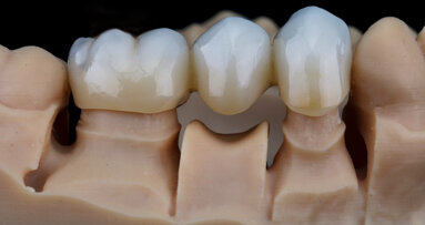 H3D busca remediar escassez de técnicos com AI CAD para laboratórios de prótese dentária