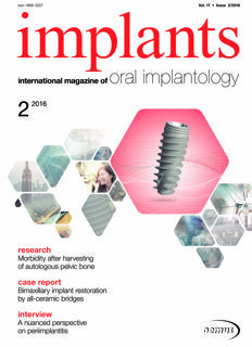 implants international No. 2, 2016